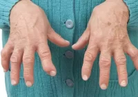 Մարդու իրավունքների պաշտպանը՝ «Լուսէ» վերականգնողական կենտրոն» հիմնադրամում․ քննարկվել են հաշմանդամություն ունեցող անձանց խնդիրները